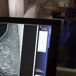 periodicidade-de-mamografias-divide-medicos-e-autoridades-de-saude