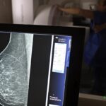 cancer-de-mama:-uma em-cada-tres pacientes tem-menos-de-50-anos