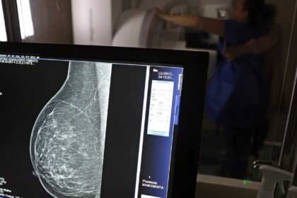 ministerio-da-saude-passa-a-recomendar-mamografia-a-partir-dos-40-anos