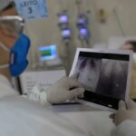 covid-e-principal-causa-de-internacao-por-sindrome-respiratoria-no-rio