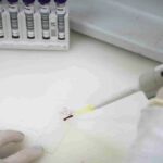paciente-em-sp-com-suspeita-de-ebola-testa-positivo-para-meningite
