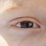 Baixa visão na infância: especialista alerta para diagnóstico precoce baixa-visao-na-infancia:-especialista-alerta-para-diagnostico-precoce