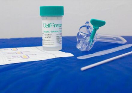 sus-detecta-quase-10-mil-testes-positivos-para-hpv-de-alto-risco
